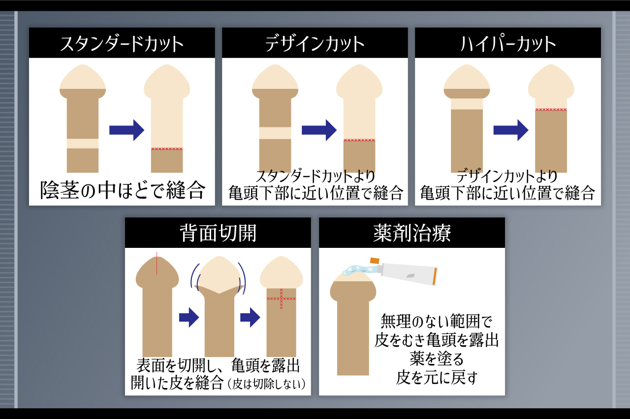 メンズライフクリニックの料金と術式